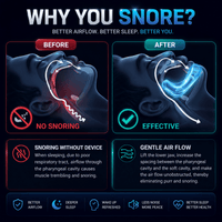 Anti Snore Mouth-Piece/ Anti-Snoring Mouth Guard