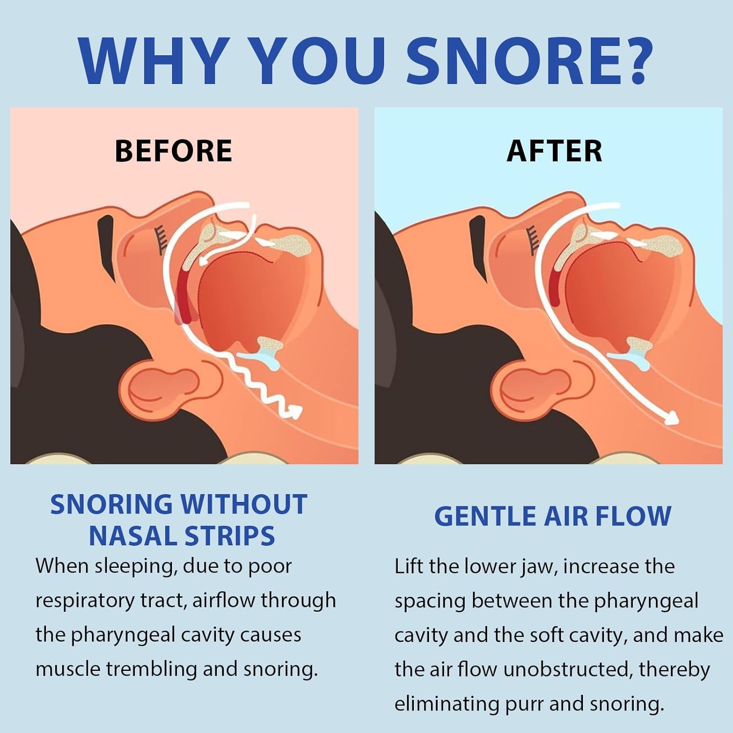 Anti Snore Mouth-Piece